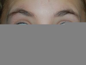 olhos-vermelhos copy