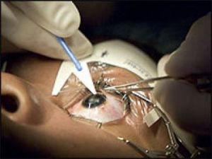 b_300_0_16777215_00_images_stories_surgery.jpg