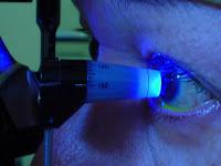 Eu tenho chance de desenvolver Glaucoma?
