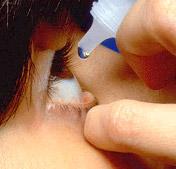 Anti-inflamatório oral melhora significativamente sinais e sintomas do olho seco