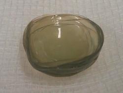 Médica encontra 27 lentes de contato perdidas em olho de paciente 