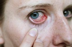 Poluição atmosférica: inimiga dos olhos