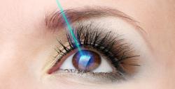 Cirurgia refrativa: tudo o que você precisa saber antes de fazer