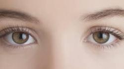 Oftalmopatia de Graves: o elo entre os olhos saltados e o hipertiroidismo