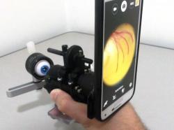 Equipamento brasileiro reduz custo de exames de visão 