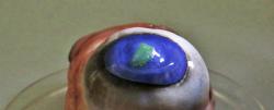Criadas lentes de contato com raio laser