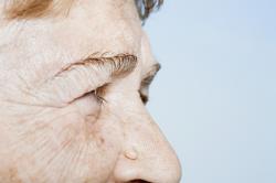 Dicas de cuidados com os olhos Dicas de cuidados com os olhos