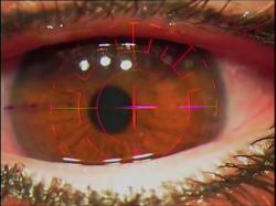 Miopia, hipermetropia, astigmatismo? Veja o tipo de cirurgia mais indicado Miopia, hipermetropia, astigmatismo? Veja o tipo de cirurgia mais indicado